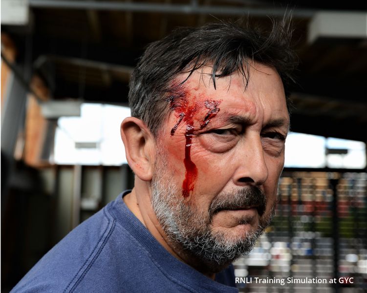 File:steve-casualty.jpg
